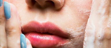 ¿Champú anticaspa para el acné del rostro? Aquí te contamos cómo funciona ¿Champú anticaspa para el acné del rostro? Aquí te contamos cómo funciona