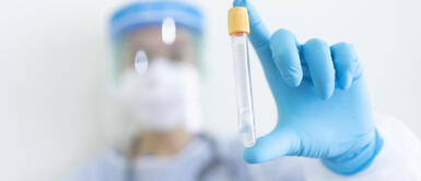 Sueroterapia: Conoce este método para fortalecer el sistema inmunológico si has tenido la Covid-19 Sueroterapia: Conoce este método para fortalecer el sistema inmunológico si has tenido la Covid-19