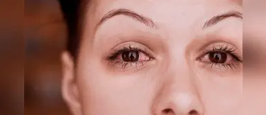 Estudio revela a la conjuntivitis como único síntoma del coronavirus, aseguran en Italia Estudio revela a la conjuntivitis como único síntoma del coronavirus, aseguran en Italia