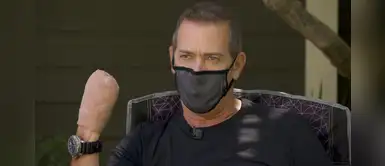 El crudo relato del hombre que venció al COVID-19 pero perdió 6 dedos en la batalla El crudo relato del hombre que venció al COVID-19 pero perdió 6 dedos en la batalla