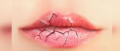 Refuerza la hidratación de tus labios con estos tips y evita la resequedad Refuerza la hidratación de tus labios con estos tips y evita la resequedad