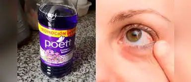 Pseudomonas: ¿Cómo la bacteria encontrada en desinfectantes puede afectar a la visión? Pseudomonas: ¿Cómo la bacteria encontrada en desinfectantes puede afectar a la visión?