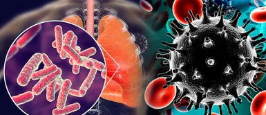 Médicos peruanos investigan interacción entre tuberculosis y COVID-19 Médicos peruanos investigan interacción entre tuberculosis y COVID-19