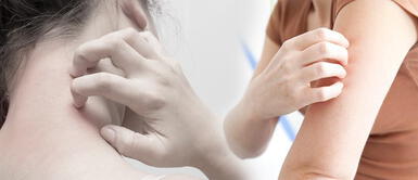 Signos en la piel que pueden indicar que tienes la COVID-19 Signos en la piel que pueden indicar que tienes la COVID-19