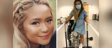 Enfermera perdió una pierna mientras luchaba contra la COVID-19 | FOTOS Enfermera perdió una pierna mientras luchaba contra la COVID-19 | FOTOS