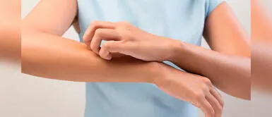 Estos son los signos en la piel que pueden indicar que una persona tiene COVID-19 | VIDEO Estos son los signos en la piel que pueden indicar que una persona tiene COVID-19 | VIDEO