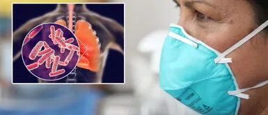 ¿Cuáles son las secuelas que deja la COVID-19 en el pulmón? ¿Cuáles son las secuelas que deja la COVID-19 en el pulmón?