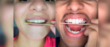 Especialista alerta sobre peligro de viral Tik Tok al limar los dientes Especialista alerta sobre peligro de viral Tik Tok al limar los dientes