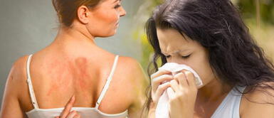 ¿Personas alérgicas son población de alto riesgo ante el coronavirus? ¿Personas alérgicas son población de alto riesgo ante el coronavirus?