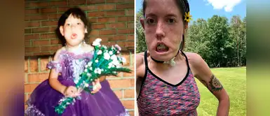 Mujer con anomalía facial pide “normalizar todos los cuerpos” Mujer con anomalía facial pide “normalizar todos los cuerpos”