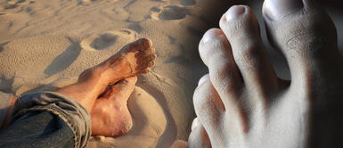 ¿Por qué salen hongos en las uñas y cómo tratarlos? ¿Por qué salen hongos en las uñas y cómo tratarlos?