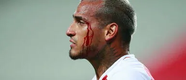 Miguel Trauco: Su valiente reacción tras sangrar y retornar a la cancha Miguel Trauco: Su valiente reacción tras sangrar y retornar a la cancha