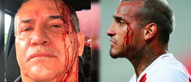 Daniel Urresti se compara con Miguel Trauco con foto de agresión Daniel Urresti se compara con Miguel Trauco con foto de agresión