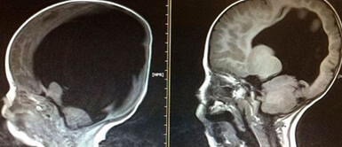 Escáner cerebral mostró que un estudiante universitario no tenía cerebro Escáner cerebral mostró que un estudiante universitario no tenía cerebro