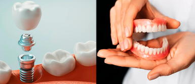 ¿Qué cuidados debe tener una prótesis dental? ¿Qué cuidados debe tener una prótesis dental?
