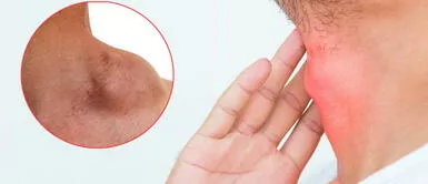 Linfoma: ¿Qué es y por qué debemos estar alertas? Linfoma: ¿Qué es y por qué debemos estar alertas?