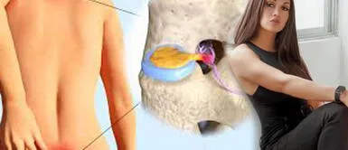 Hernias lumbares causan preocupación a Angie Arizaga: "El dolor es muy fuerte" Hernias lumbares causan preocupación a Angie Arizaga: "El dolor es muy fuerte"