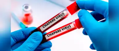 Virus Chapare fue detectado en Bolivia y puede transmitirse de manera fácil Virus Chapare fue detectado en Bolivia y puede transmitirse de manera fácil