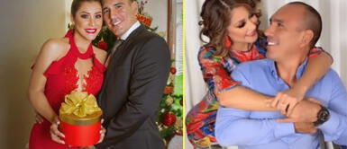 Esposo de Karla Tarazona revela que sufrió terrible quemadura en su rostro Esposo de Karla Tarazona revela que sufrió terrible quemadura en su rostro