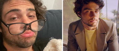 Noah Centineo se somete a una cirugía de urgencia Noah Centineo se somete a una cirugía de urgencia