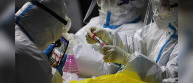 Hallan la segunda 'llave' que utiliza el coronavirus para meterse en los pulmones Hallan la segunda 'llave' que utiliza el coronavirus para meterse en los pulmones