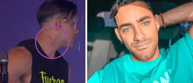 Austin Palao rompe su silencio tras ser retirado de Esto es Guerra Austin Palao rompe su silencio tras ser retirado de Esto es Guerra