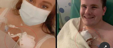 Bebé que nació con 765 gramos sobrevivió al coronavirus y a una sepsis Bebé que nació con 765 gramos sobrevivió al coronavirus y a una sepsis