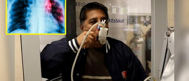 COVID-19: Cómo saber si tengo problemas en mis pulmones Coronavirus: 3 pruebas que debes hacerte para conocer el estado de tus pulmones