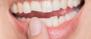 Japón: Científicos descubren cómo hacer crecer los dientes nuevamente Científicos japoneses descubren cómo hacer que los dientes crezcan nuevamente