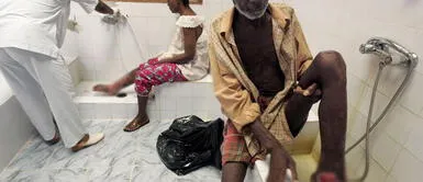 Australia: Propagación de bacteria come carne ataca extremidades y alerta comunidad médica Australia: Alerta por propagación de una bacteria que come carne y huesos