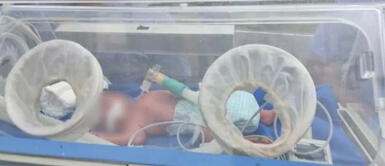 COVID-19 Brasil: Médica embarazada fallece de coronavirus pero su bebé sobrevive Brasil: Médica embarazada muere de COVID-19, pero su bebé logra salvarse