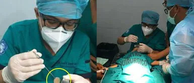 Loreto: Cirujanos extraen moneda de sol que se tragó una niña de 1 año y tres meses de edad Loreto: Cirujanos extraen con éxito moneda que se tragó una bebé de 1 año y tres meses