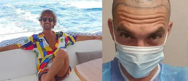 Antonio Pavón contento con su trasplante capilar Antonio Pavón contento con su trasplante capilar: ‘Feliz con la tecnología de injertos’