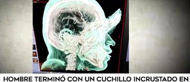 Delincuentes le clavan cuchillo a hombre que salió en defensa de su cuñado Delincuentes le clavan cuchillo a hombre que salió en defensa de su cuñado