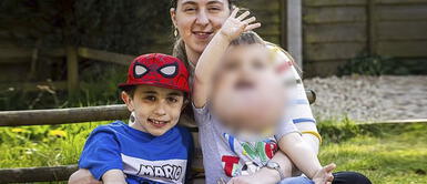 Niño de cuatro años con quistes gigantescos lograr dar sus primeros pasos Niño de cuatro años con tumor gigantesco lograr dar sus primeros pasos