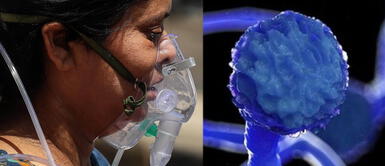 COVID-19 India: Qué es la mucormicosis el mortal hongo negro que afecta a pacientes con coronavirus Mucormicosis, la afección que ataca a las personas contagiadas de COVID-19 en India