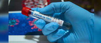 COVID-19 Perú: Científicos estudian fármaco para acabar con el coronavirus Científicos peruanos investigan fármaco para combatir la COVID-19