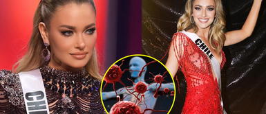 Miss Universo 2021: Daniela Nicolás se defiende por comentarios en Instagram sobre trastorno autoinmune "Ojalá te quedes postrada": Daniela Nicolás respondió fuerte comentario por su enfermedad