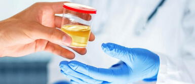 ¿Por qué la orina cambia de color y cuál es el tono normal? ¿Por qué la orina cambia de color y cuál es el tono normal?