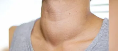 Endocrinólogo revela que trastornos tiroideos son más frecuentes en mujeres de edad fértil Más de 8 millones de mujeres en edad fértil podrían tener un trastorno tiroideo