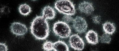 COVID-19: Investigadores hallan una forma de inhibir la multiplicación del coronavirus Científicos descubren "punto débil" de la COVID-19 que evitaría que se multiplique en el organismo