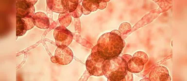 COVID-19 India: Candida auris hongo resistente a los antibióticos que amenaza a la recuperación de contagiados con coronavirus Candida auris, el hongo mortal resistente a los antibióticos que impide la recuperación de pacientes COVID-19 en India