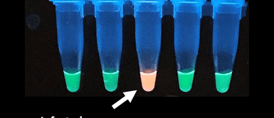 Científicos peruanos desarrollan prueba que detecta la COVID-19 a través de la saliva Científicos peruanos desarrollan prueba que detecta la COVID-19 a través de la saliva