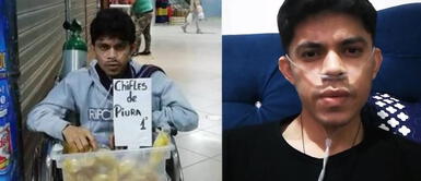 Piura: Joven que sufre de fibrosis pulmonar vende chifles por TikTok para pagar trasplante de pulmón Piura: Joven con fibrosis pulmonar vende chifles por TikTok para pagar su trasplante