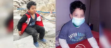 SJL: Menor al que le extirparon el ojo por cáncer requiere una prótesis ocular y apoyo económico video SJL: Niño necesita una prótesis ocular y ayuda económica tras extirpación de su ojo por cáncer