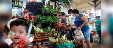 Cómo alimentar a un bebé con paladar hendido según nutricionista Adriana Zavalaga ¿Cómo debe ser la alimentación de menores que sufren paladar hendido?