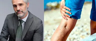 Juan Pablo Medina fue amputado para salvarle la vida tras padecer trombosis Trombosis, el mal de Juan Pablo Medina de “La casa de las flores” que causó la amputación de su pierna