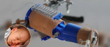 Perú: Científicos elaboran sistema robótico de bajo costo para la rehabilitación de bebés con espina bífida Científicos desarrollan sistema robótico de bajo costo para la rehabilitación de bebés con espina bífida