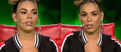 Aída Martínez demanda a clínica. Aída Martínez denuncia mala intervención estética en sus labios: "Me salieron unas pelotas. No puedo comer"