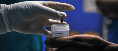 Confirman nuevo caso de hongo negro en mujer que logró superar la COVID-19 Confirman nuevo caso de hongo negro en mujer que logró superar la COVID-19